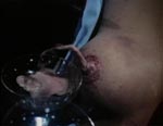 En af filmens mere bizarre scener, hvor morderen klipper brystvorten af et offer, og der kommer chokolademælk ud En af filmens mere bizarre scener, hvor morderen klipper brystvorten af et offer, og der kommer chokolademælk ud.