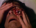 Rodney får en nål i øjet – filmens mest splattede scene.